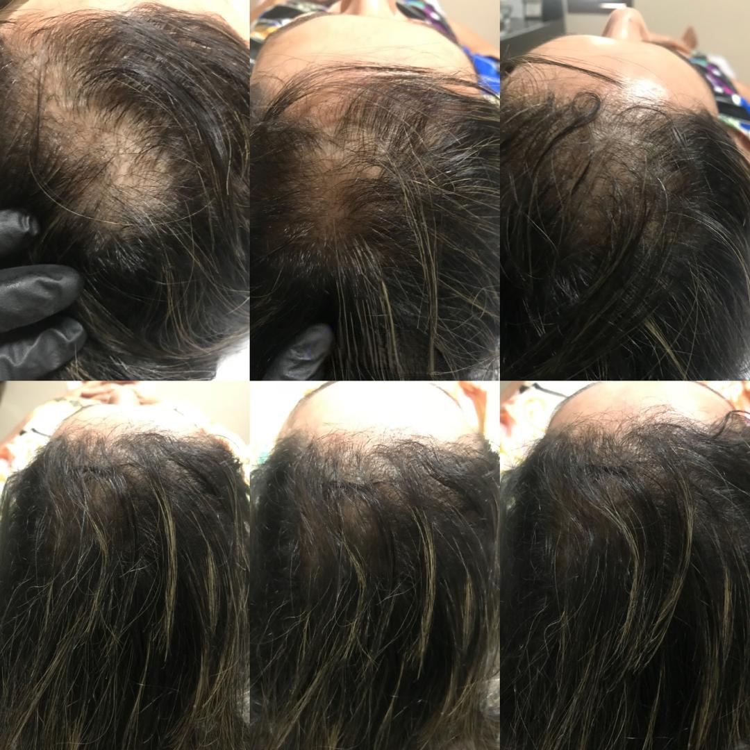 Antes e depois - afinamento de cabelo